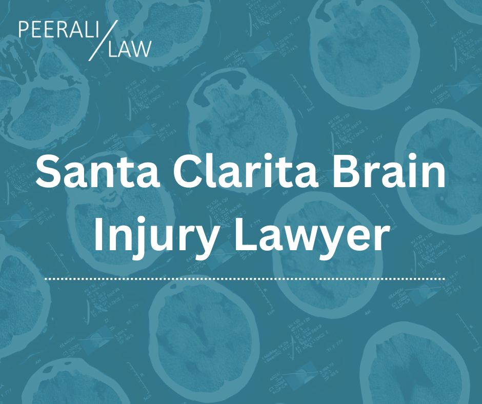 Santa Clarita Brain Injury Lawyer