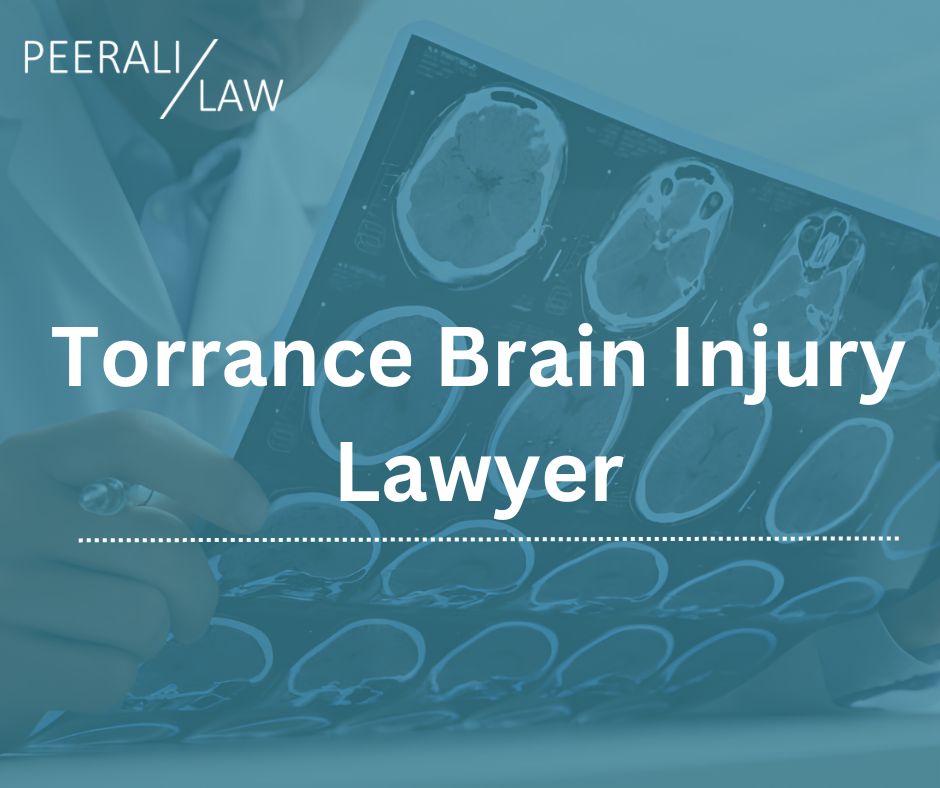 Torrance Brain Injury Lawyer