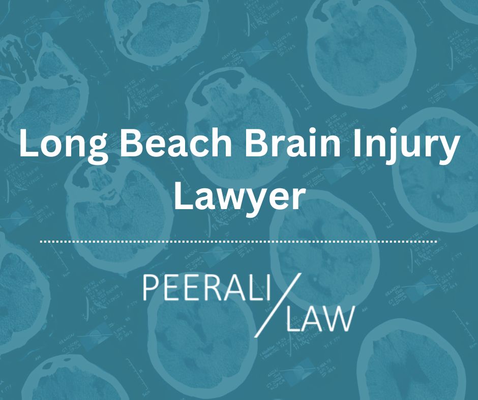 brain injury lawyer long beach